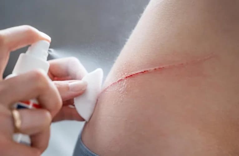 ၁ စက္ကန့်အတွင်း သွေးတိတ်စေမယ့် ကိုရီးယားပညာရှင်တွေရဲ့ “မှော်စပရေး”